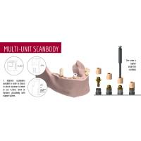 Scanbody for Multi-Unit